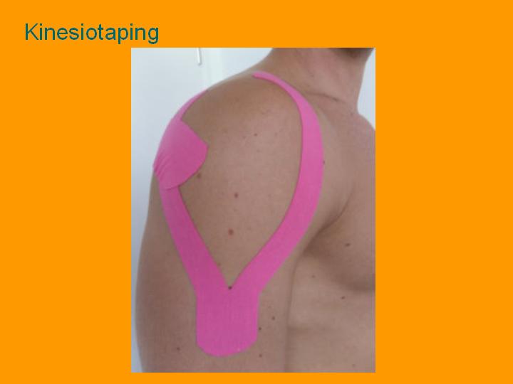 Kinesiotaping